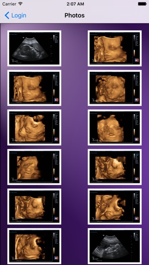 Your Baby Scan - Photo Locker(圖2)-速報App