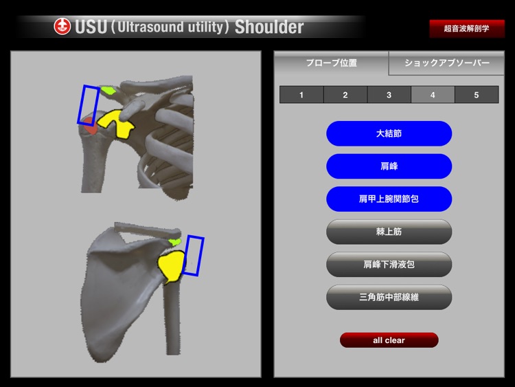 USU Shoulder screenshot-3