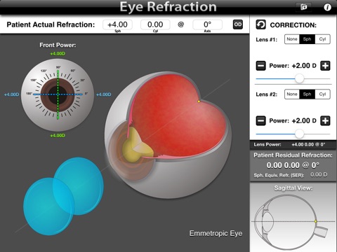 Eye Refraction screenshot 3