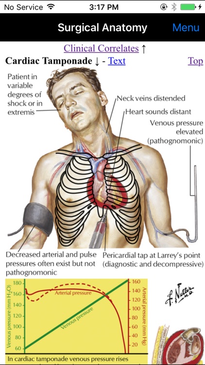 Netter's Surgical Anatomy Review P.R.N. screenshot-3