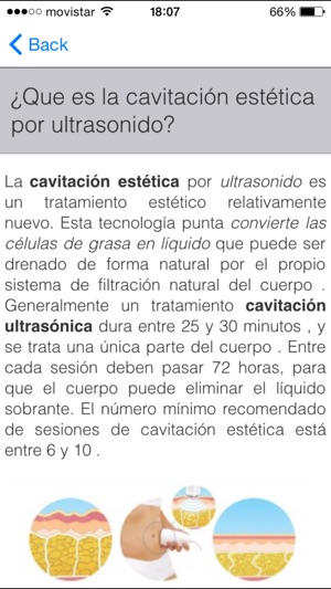 Cavitacion Estetica(圖2)-速報App