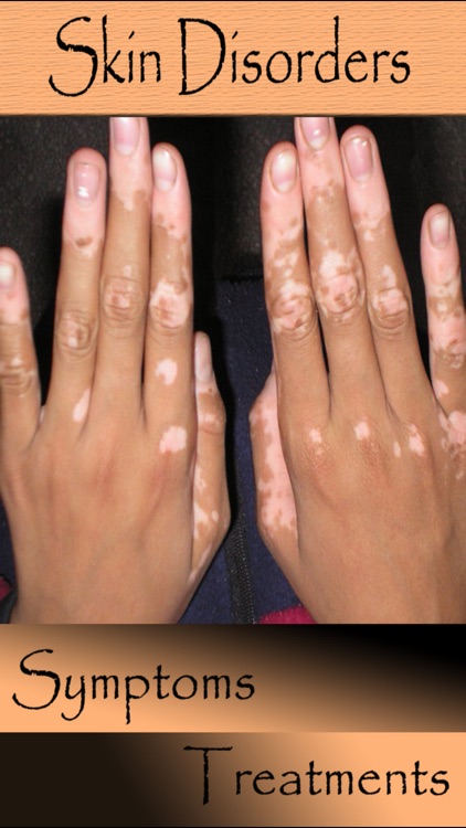 Most Skin Disorders
