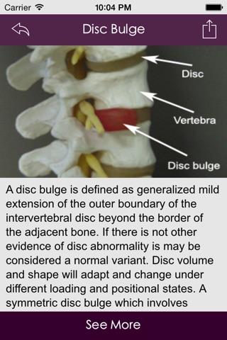 Spine Conditions & Treatment screenshot 3