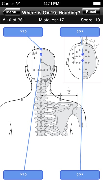 Acupuncture Points Body Quiz screenshot-3