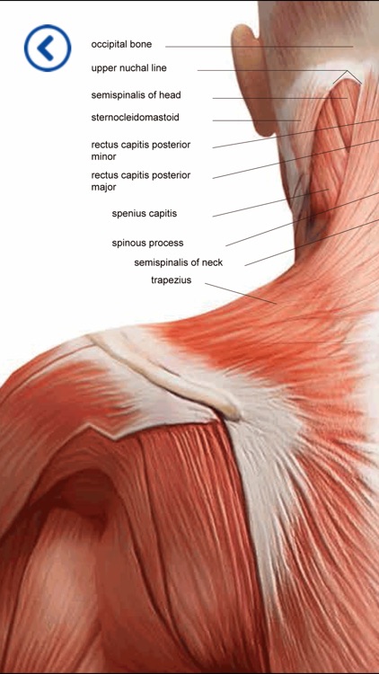 Mectronic