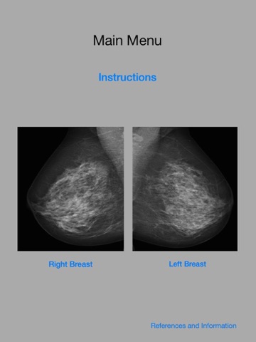 Mammography Localizer screenshot 4