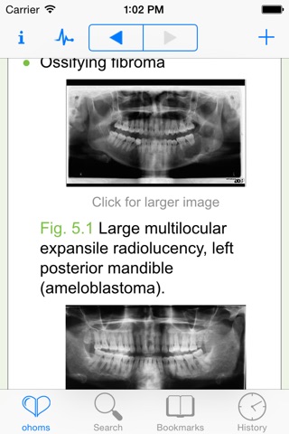 Oxford Handbook of Oral and Maxillofacial Surgery screenshot 3