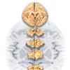 Miniatlas Central Nervous System