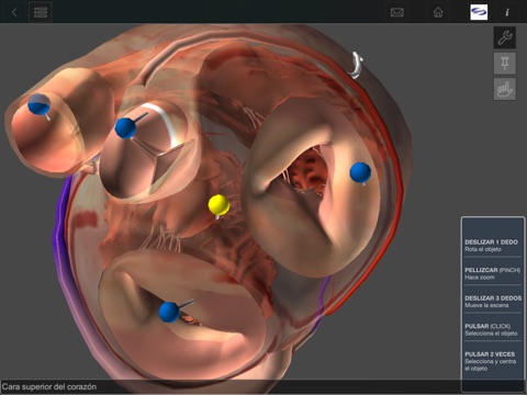 3D Hipertensión e hipercolesterolemia screenshot 2