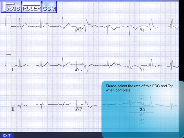 ECG Genius(圖3)-速報App