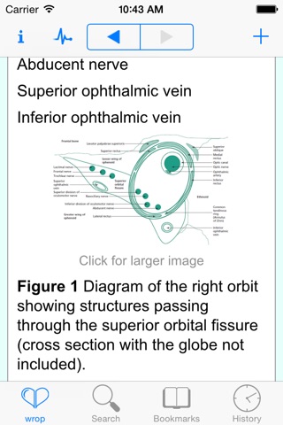 Rapid Ophthalmology screenshot 3