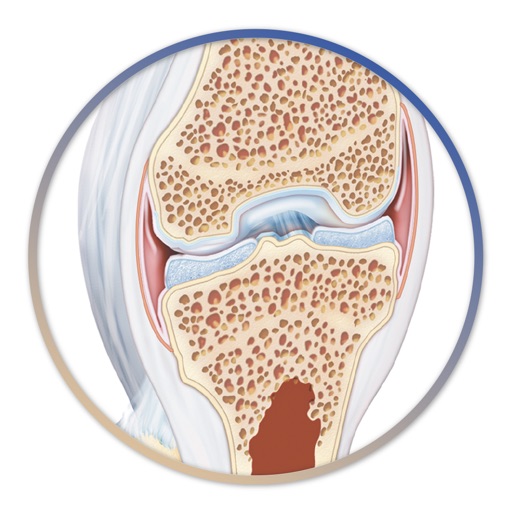 Miniatlas Joint Diseases