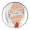 Would you like to enhance communication with your patients so they can better understand the anatomy, physiology or pathology of their psoriatic condition