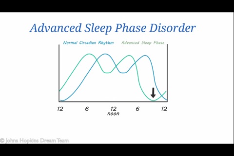 MySleep101 - animated educational modules on sleep disorders screenshot 3