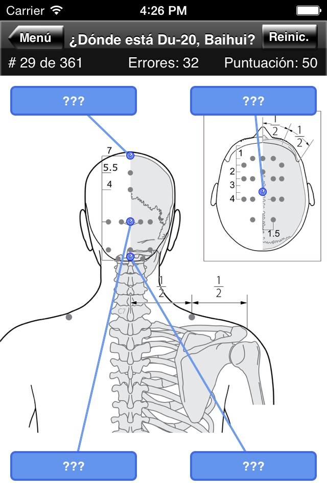 Acupuncture Points Body Quiz screenshot 4