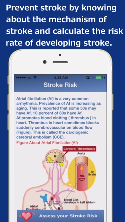 Heart_Rhythm screenshot-3