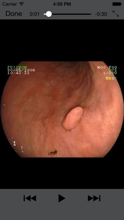 ENDO3® Atlas of Gastrointestinal Endoscopy screenshot-3