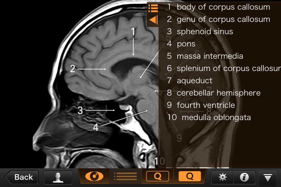 Interactive CT and MRI Anatomy screenshot 3