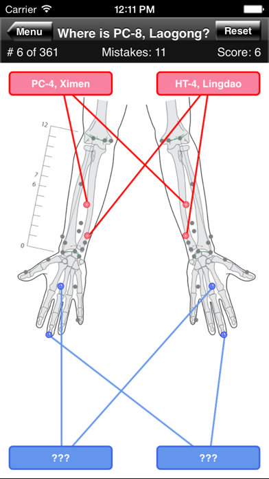 How to cancel & delete Acupuncture Points Body Quiz from iphone & ipad 3