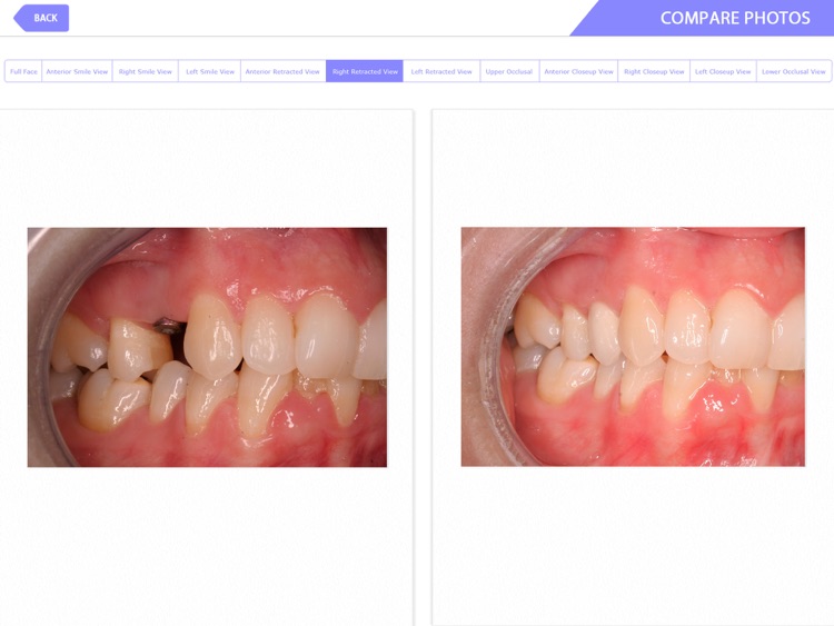 Gizgil Dental Imaging screenshot-3