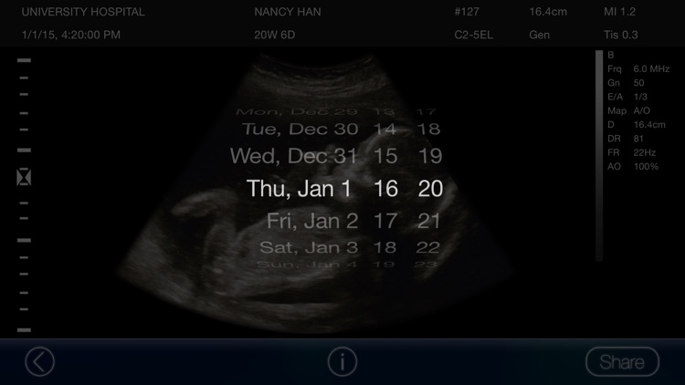 Mom, I'm pregnant - Ultrasound Prank screenshot-3