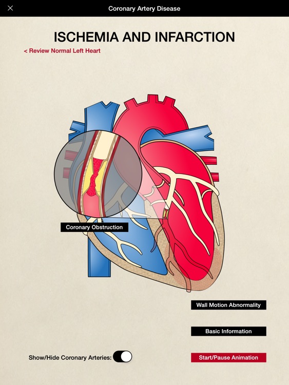 HeartCharts screenshot-0