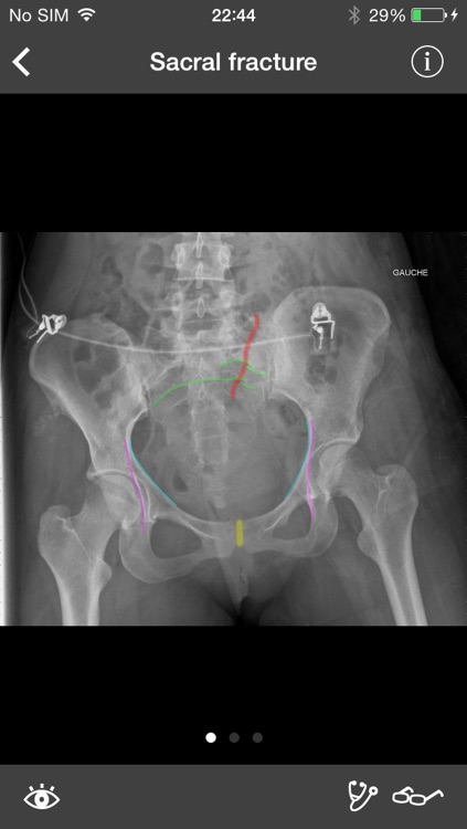 RealWorld Orthopaedics
