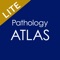 ATLAS OF PATHOLOGY And Comparison With Normal Anatomy Lite