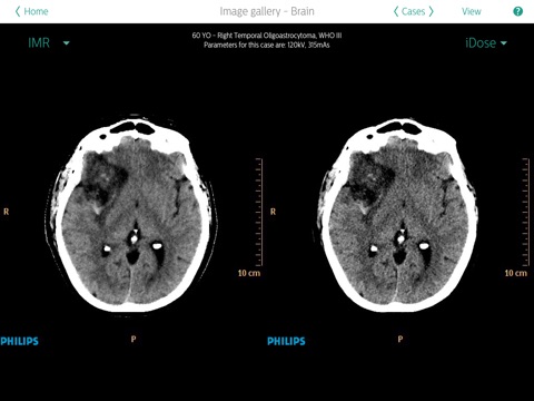 Philips IMR Review for Physicians screenshot 2