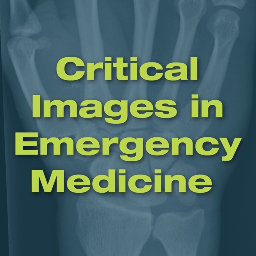 Critical Images in Emergency Medicine icon