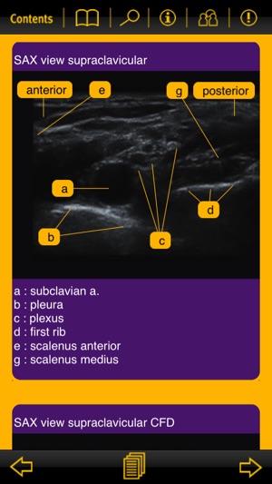 Nerve Blocks(圖5)-速報App