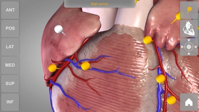 心臓解剖 Heart 3D Atlas o... screenshot1
