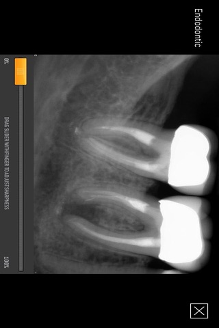 Sirona Intraoral Products for iPhone screenshot 3