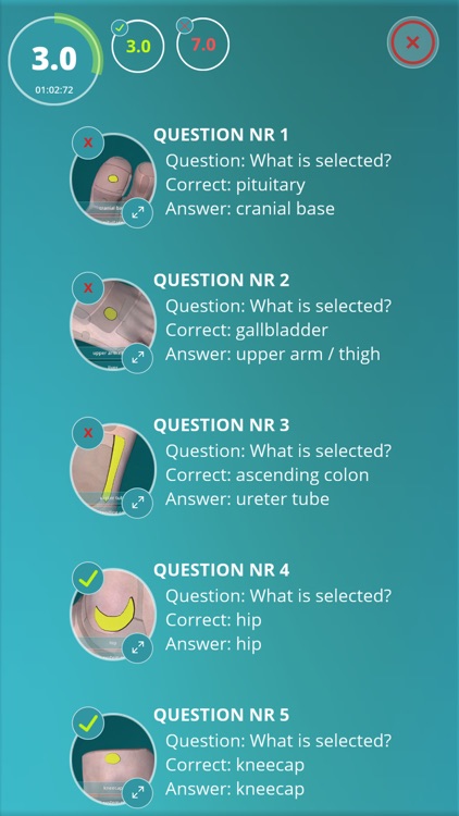 Reflexology Quiz - zones screenshot-3