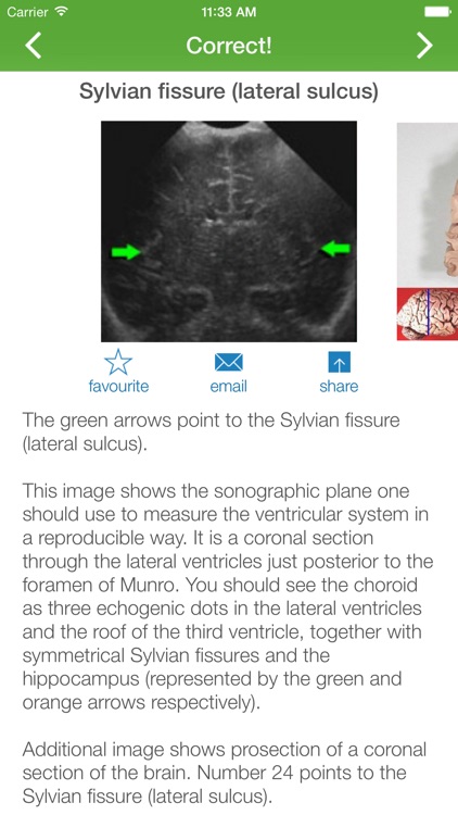 Cranial Ultrasound