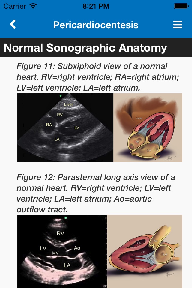 SonoSupport: a clinical emergency medicine and critical care ultrasound reference tool screenshot 2