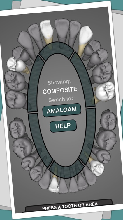 CavSim : 3D Dental Restorative Tooth Cavity Preparation