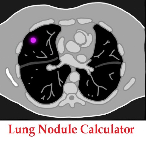 iLungNoduleCalculator