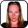 Sun Burn Face