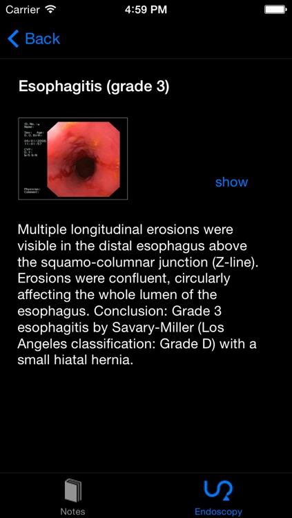 ENDO3® Atlas of Gastrointestinal Endoscopy