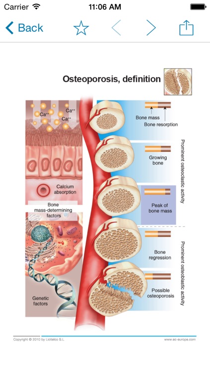 Miniatlas Osteoporosis screenshot-3