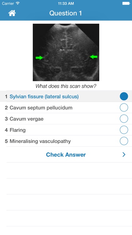 Cranial Ultrasound