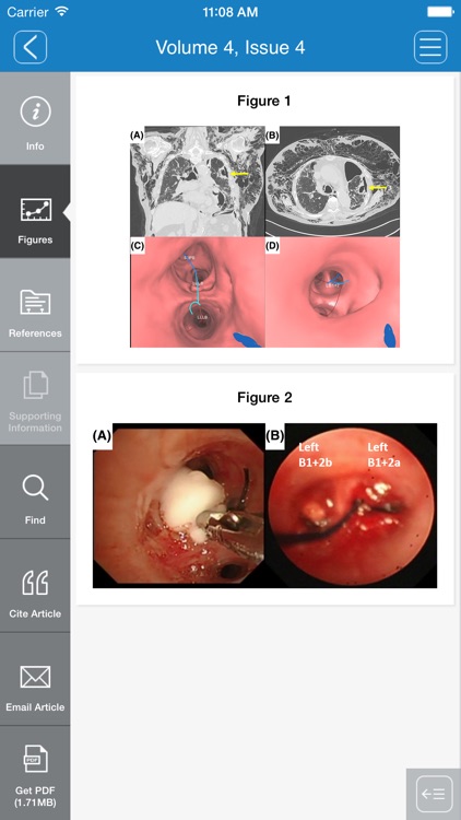 Respirology Case Reports