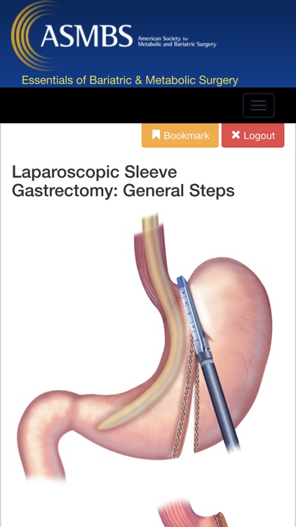 Essentials of Bariatric & Metabolic Surgery screenshot-4