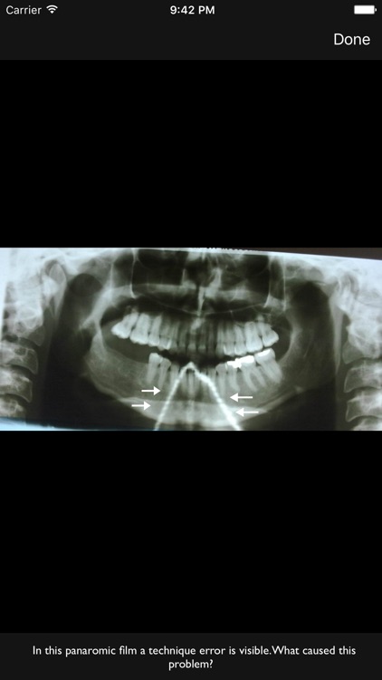 Oral Radiology screenshot-3