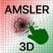 The most advanced Amsler Grid available