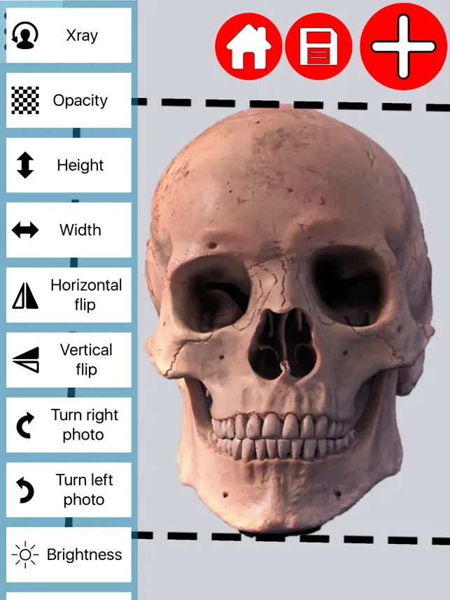 Captura 1 Xray Photo Creator iphone