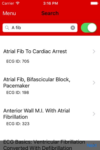 ECG Guru screenshot 3