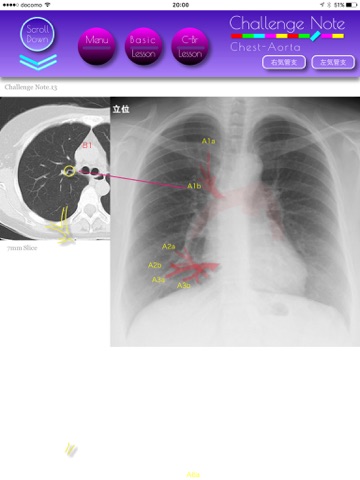 Challenge Note Lung CT screenshot 3