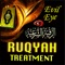 TREATMENT OF JINN AFFLICTION, BLACK MAGIC/SIHR, EVIL EYE/AYN, AND ENVY/HASAD IN THE LIGHT OF QUR'AN & SUNNAH